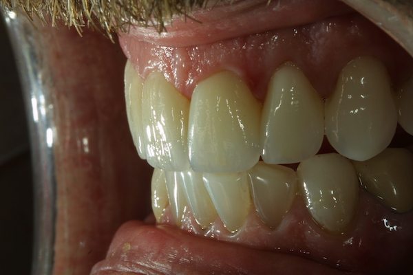 Natural Dental Result