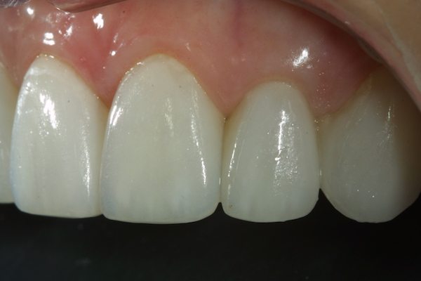 Natural Dental Result