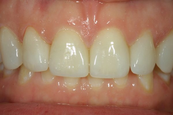 Natural Dental Result