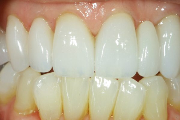 Natural Dental Result