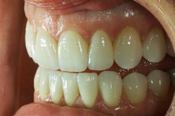 Natural Dental Result