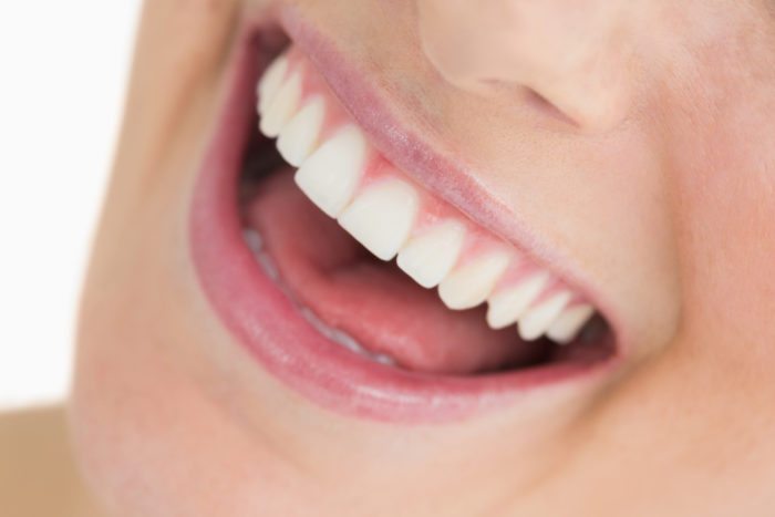 How Dental Bridges Can Help Your Smile