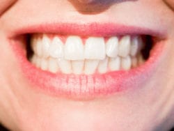 5 Indicators That You May Need Dental Implants