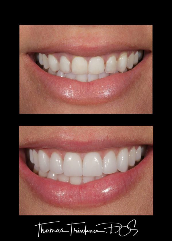 View Portfolio Of Dental Work by Columbia SC Dentist Dr. Trinkner