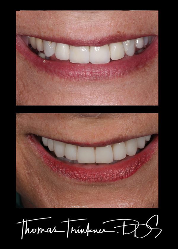 View Portfolio Of Dental Work by Columbia SC Dentist Dr. Trinkner