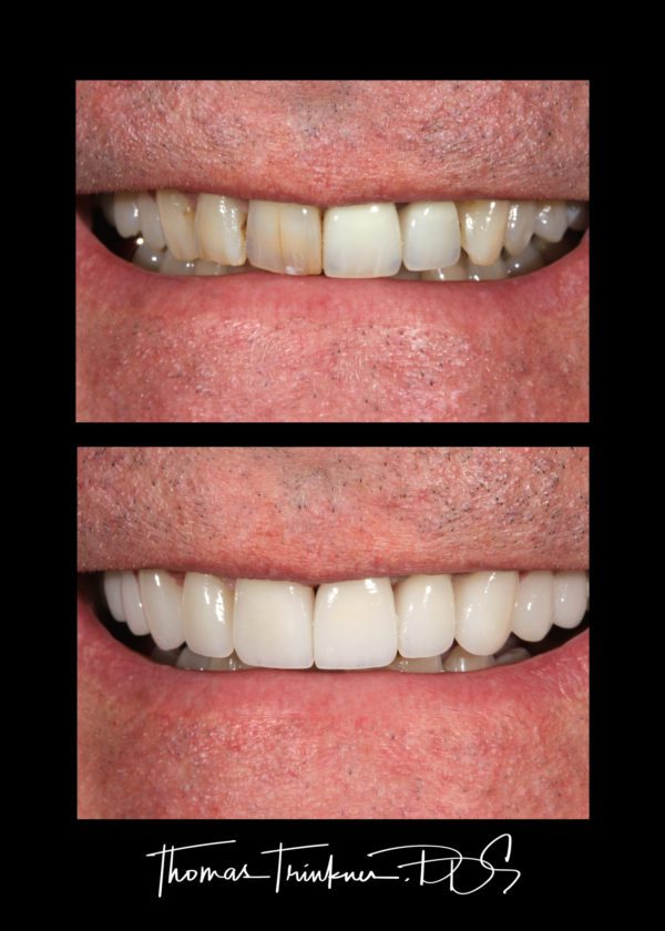 View Portfolio Of Dental Work by Columbia SC Dentist Dr. Trinkner