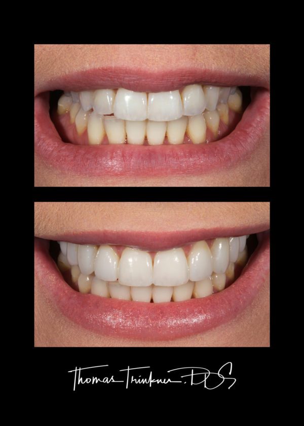 View Portfolio Of Dental Work by Columbia SC Dentist Dr. Trinkner