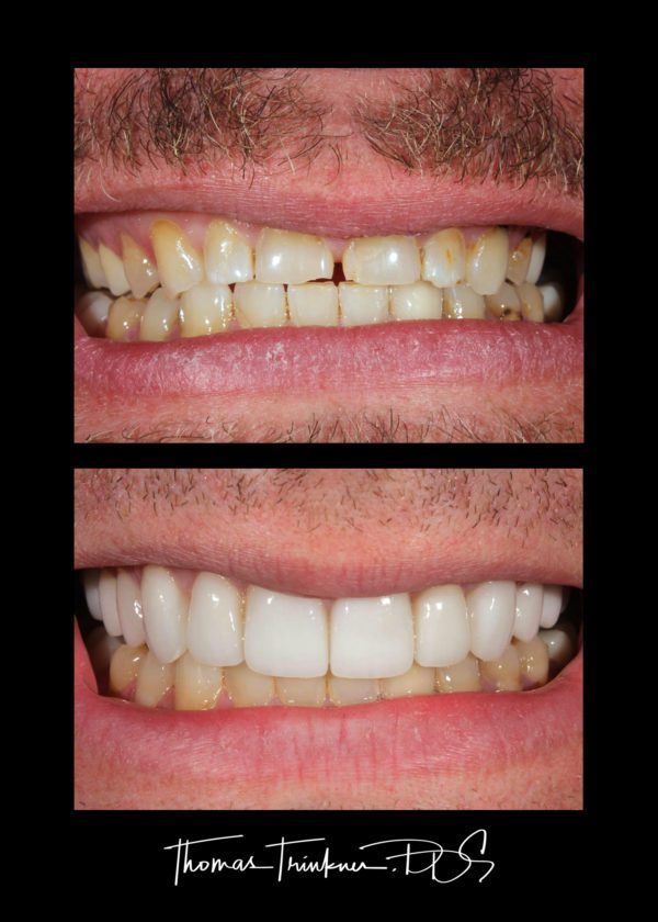 View Portfolio Of Dental Work by Columbia SC Dentist Dr. Trinkner