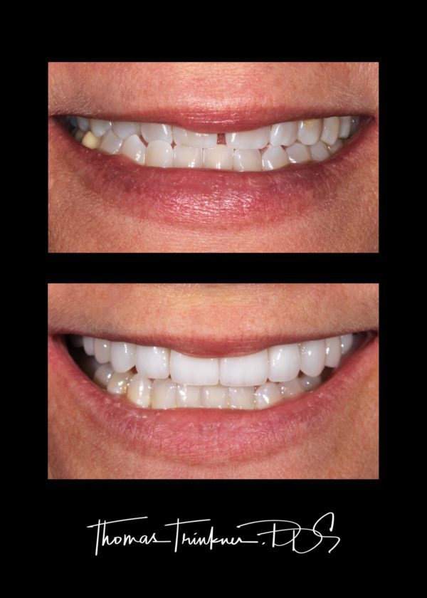 View Portfolio Of Dental Work by Columbia SC Dentist Dr. Trinkner
