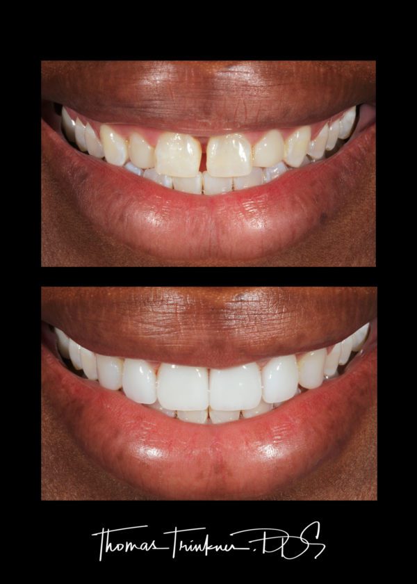 View Portfolio Of Dental Work by Columbia SC Dentist Dr. Trinkner