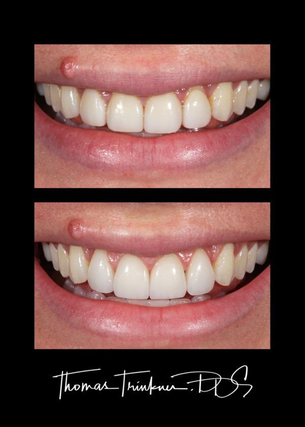 View Portfolio Of Dental Work by Columbia SC Dentist Dr. Trinkner