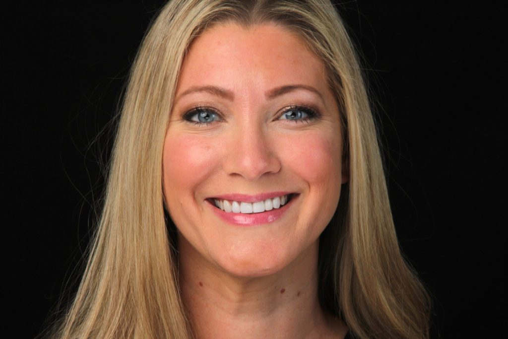 Dental patient results after teeth whitening