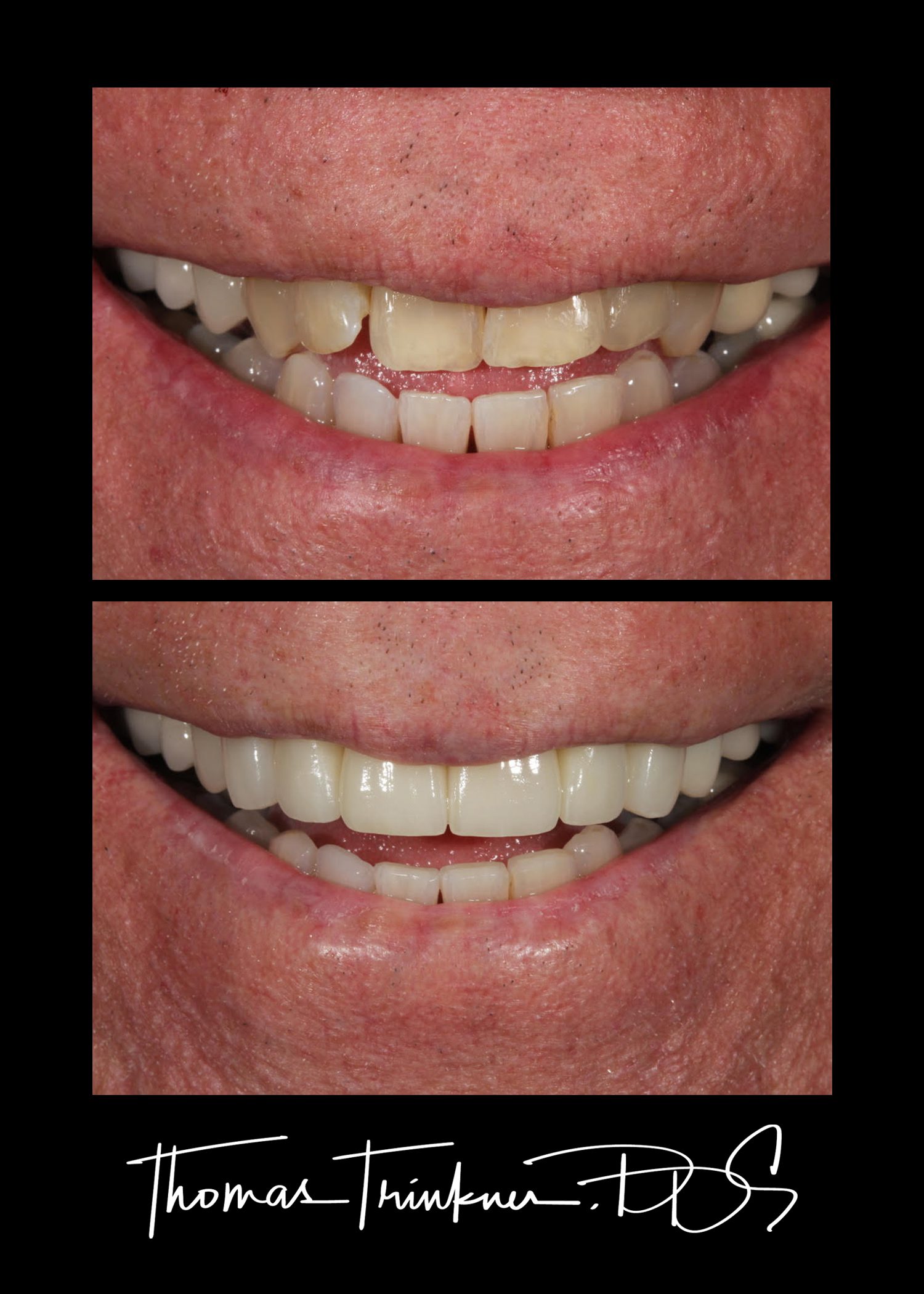 Before and after cosmetic dentistry